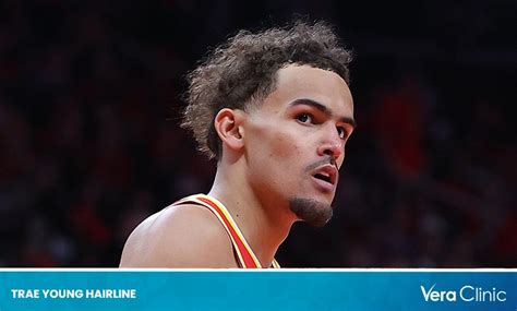 Trae Young Hairline: Unraveling the Mystery