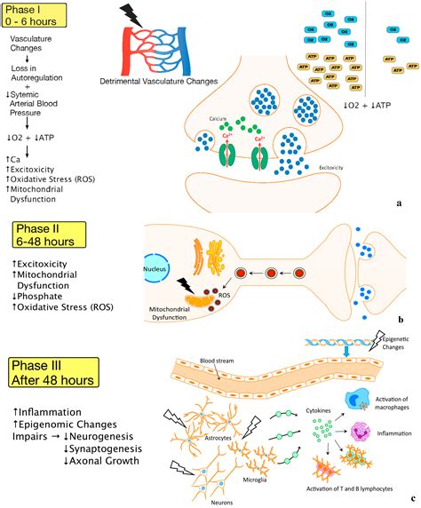 Perinatal Hypoxic Ischemic Encephalopathy