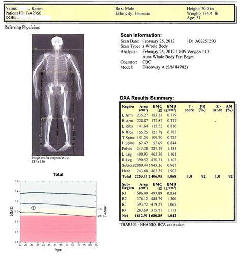 Karim's Health and Fitness Blog: Body Fat Measuring with a DXA (DEXA) Scan