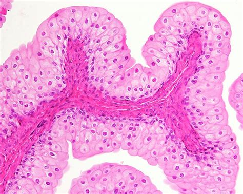 Urinary Bladder Epithelium Photograph by Jose Calvo / Science Photo Library - Fine Art America