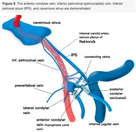 Internal Carotid Artery Cavernous Sinus