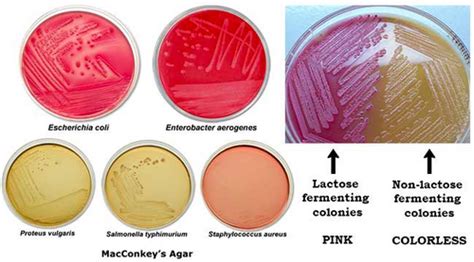 👉 MacConkey Agar - Purpose, Test and Results (February 2022)