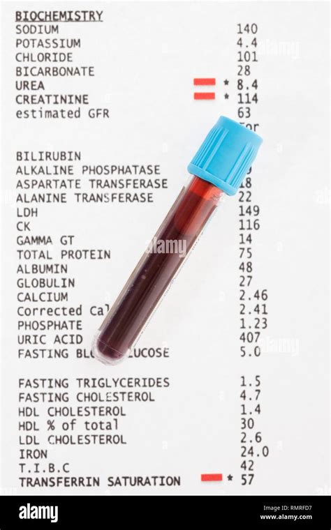 Blood test results with blood sample Stock Photo - Alamy