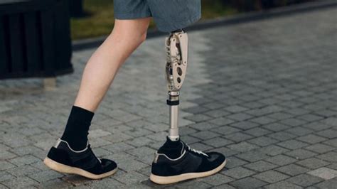 Prosthetic Leg at Less Price | Prosthetic leg, Prosthetics, Legs