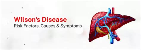 Wilson's Disease: Risk Factors, Causes, & Symptoms | CK Birla Hospital