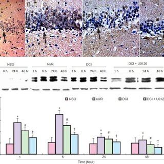 Effects of extracellular signal-regulated kinase 1/2 pathway inhibition... | Download Scientific ...