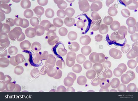 8 Trypanosoma slide Images, Stock Photos & Vectors | Shutterstock