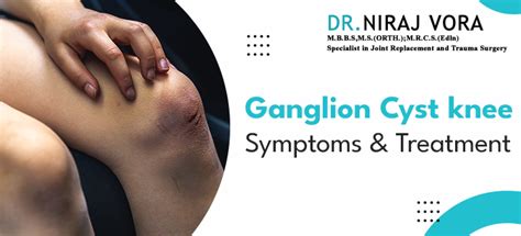 Ganglion Cyst Knee Symptoms and Treatment | Dr Niraj Vora