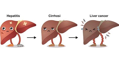 Get an Overview of Hepatocytes- CUSABIO