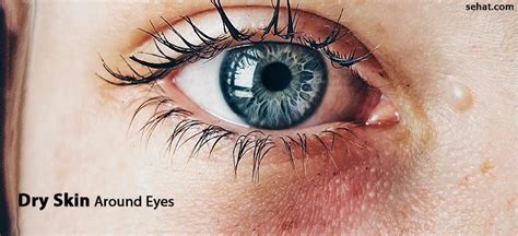 Dry Skin Around Eyes- Causes And Home Remedies