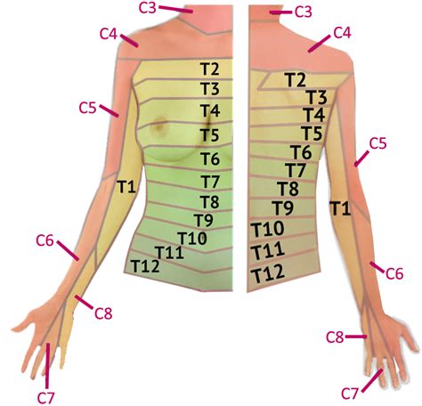 Upper Extremity Dermatome Map