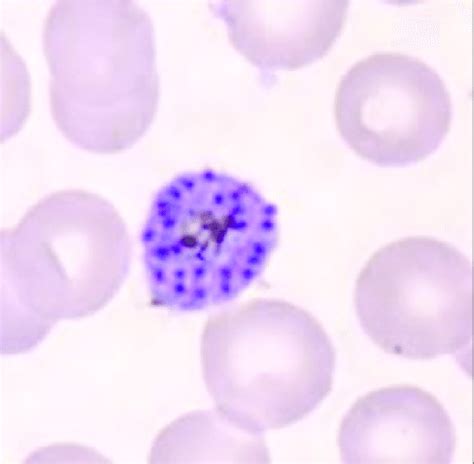 List 101+ Pictures What Does Malaria Look Like Under A Microscope Updated 10/2023