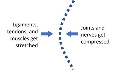 What Is Degenerative Scoliosis? - Regenexx