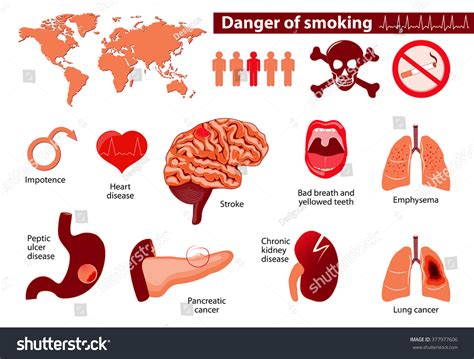 Danger Smoking Signs Symptoms Stage Risk Stock Vector (Royalty Free ...