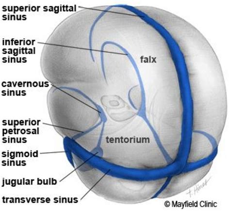 Illustration the two major dural folds the falx and tentorium along with the venous sinuses. # ...