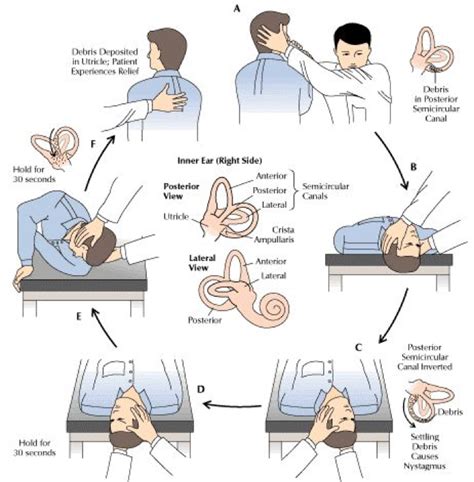 What is vertigo and its treatment options | by Wellzio | Medium