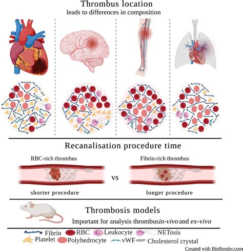 Blood circulation model Human arterial venous cardiac cerebrovascular ...