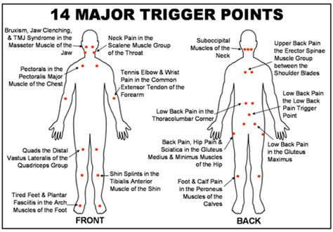 Trigger Point Therapy - VITALITY HEALTH CENTER