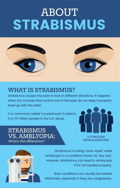 Strabismus: Natural Ways to Help Resolve ‘Crossed Eyes’ | Eye health ...