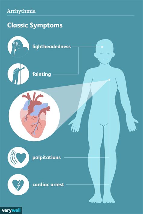 How To Prevent Arrhythmia - Economicsprogress5