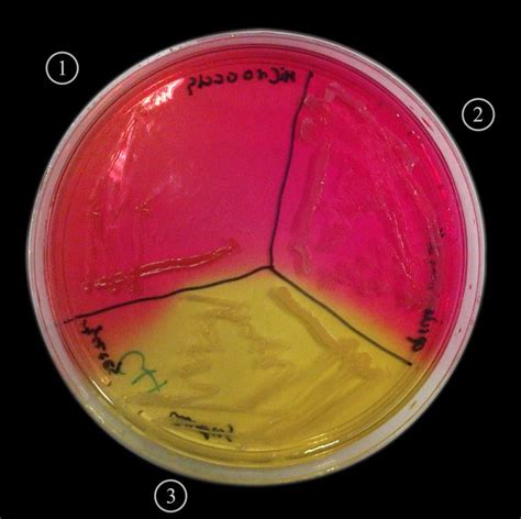 Mannitol salt agar - Alchetron, The Free Social Encyclopedia