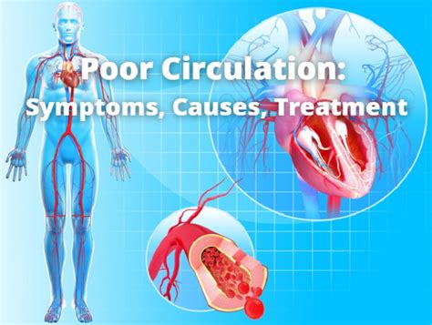 Poor Circulation: Symptoms, Causes, Treatment