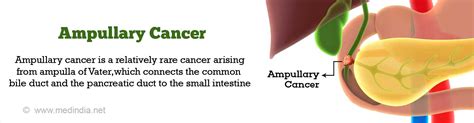 Ampullary Cancer Causes Symptoms Diagnosis Treatment