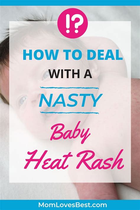 Baby heat rash 6 simple tips for treatment and prevention – Artofit