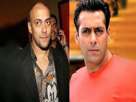 Why did Salman Khan have 3 Hair Transplants