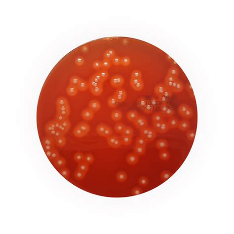 Colmubia CNA Agar, 90mm Plate - Southern Group Laboratory