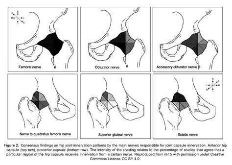 Fascia Iliaca Compartment Block: An Update : WFSA - Resources