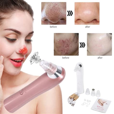 Aliexpress.com : Buy Vacuum Pore Cleaner 2 Colors Electric Facial Skin ...