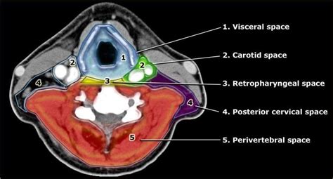 Pin on Head And Neck | Anatomy of the neck, Radiology, Anatomy