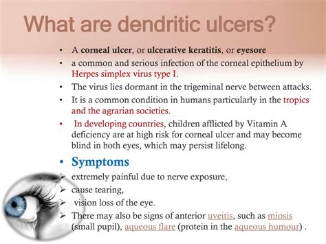 PPT - Eye infection PowerPoint Presentation, free download - ID:2049121