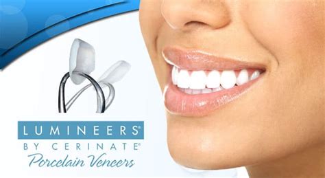 Lumineers Citrus Heights CA | New Vision Dentistry