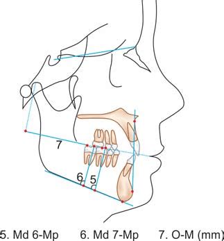 Dentoalveolar horizontal parameters | Download Scientific Diagram