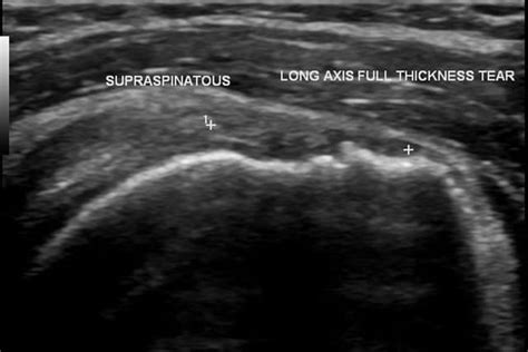 Ultrasound Scan For Diagnosis | Ultrasound Imaging | Physiocare