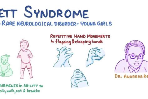 Rett Syndrome Causes, Symptoms, Stages, Treatment - ABTC