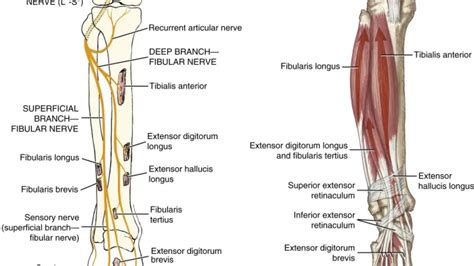 Common Peroneal Neuropathy