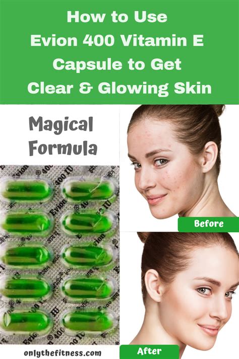 How to use evion 400 vitamin e capsule to get clear and glowing skin. And what are the benef ...