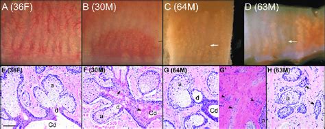 Human MG in tarsal plate and histology in MG tissue from four cadaver... | Download Scientific ...