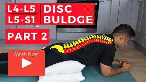 L4 L5 - L5 S1 disc bulge best exercise rehabilitation for pain relief ...