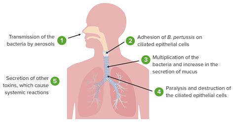 Can Chemo Cause Cough at Marcos Galindo blog