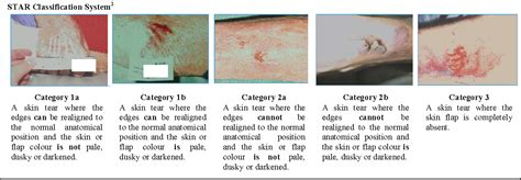 [PDF] STAR: A consensus for skin tear classification. | Semantic Scholar