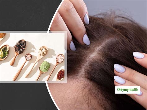 Try These 3 Ayurvedic Home Remedies To Cure Hair Loss | OnlyMyHealth