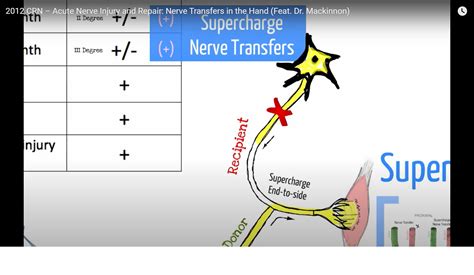 Acute Nerve Injury and Repair — OrthopaedicPrinciples.com