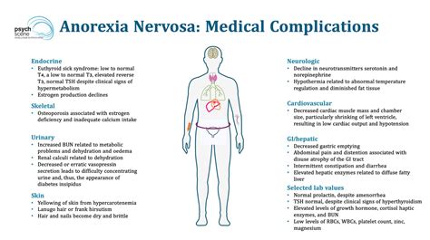 Anorexia Nervosa Concept Map