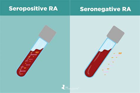 Rheumatoid Factor Is Negative: What Does It Mean?