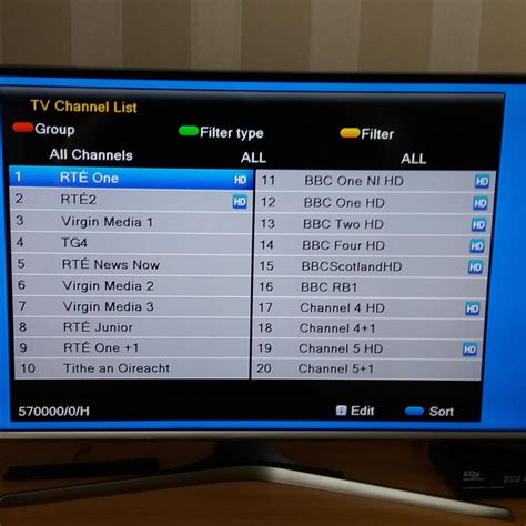 SAORVIEW AND FREE TO AIR COMBO BOX | Dublin Tv