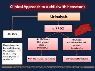 Approch to Hematuria in pediatric age group | PPT